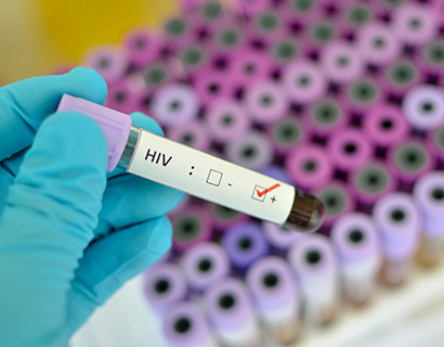 Blood sample with HIV positive